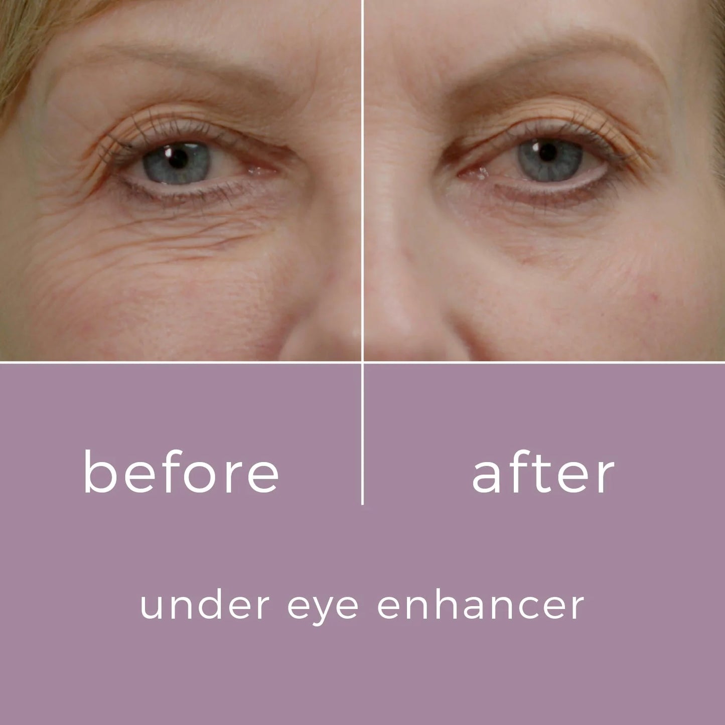SkinBunny Eye Enhancer 10g - 100 Applications