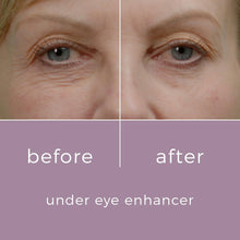 SkinBunny Eye Enhancer 10g - 100 Applications