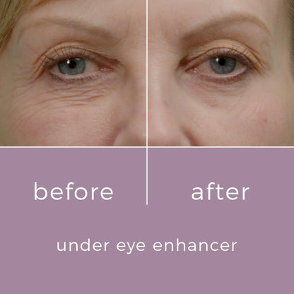 SkinBunny Eye Enhancer 10g - 100 Applications