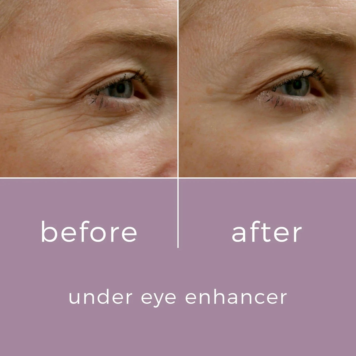 SkinBunny Eye Enhancer 10g - 100 Applications