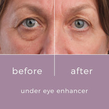 Skinbunny Under Eye Enhancer & FREE Duo Hyaluornic Acid Day Cream