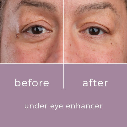Skinbunny Under Eye Enhancer & Amino Acid Face Wash