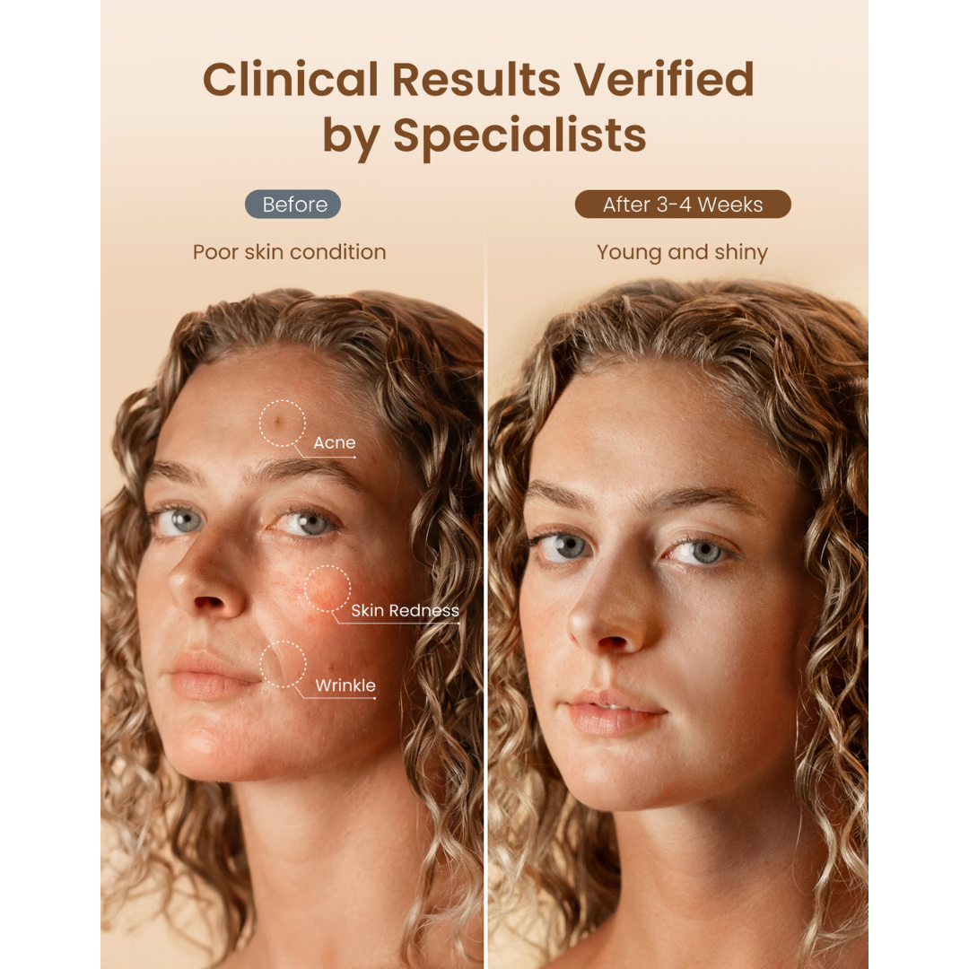 RENPHO Artemis Blush 4-Mode LED Face Mask - White